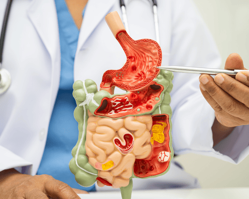 especialista-gastrointestinal-tijuana-cerca-de-mi